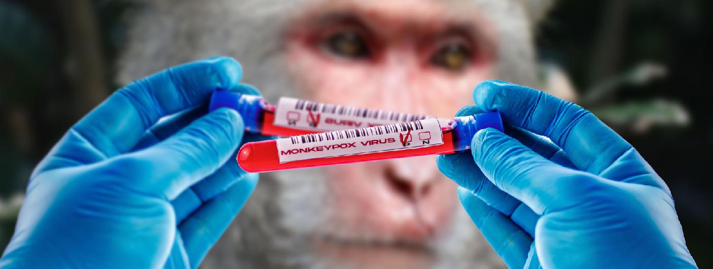 More Monkeypox Cases in Indonesia: Recognize the Symptoms 